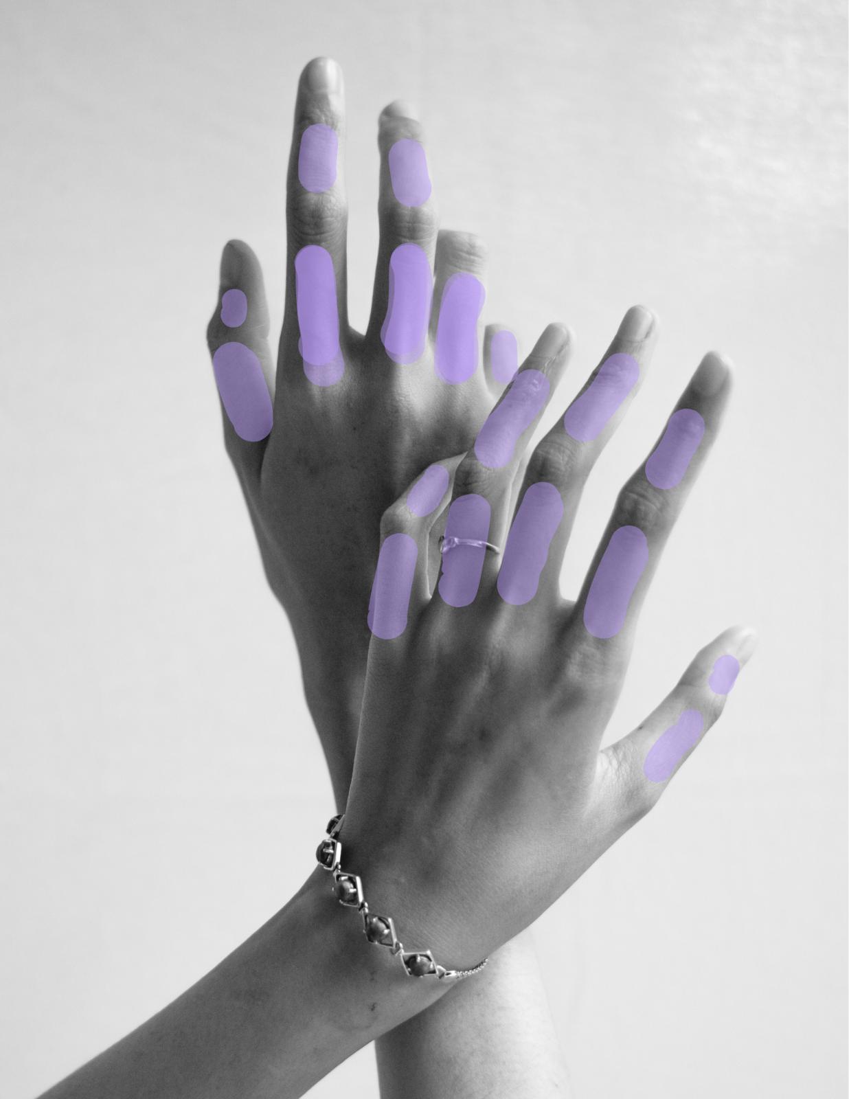 unnamed image